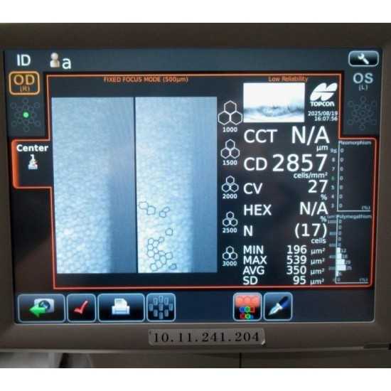 Microscope Endothélial Topcon SP-1P