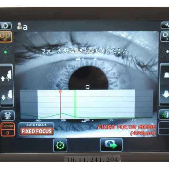 Microscope Endothélial Topcon SP-1P