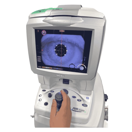 OCT Nidek RS-3000 Advance OCT Nidek RS-3000 Advance