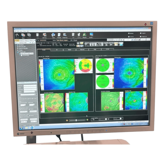 OCT Nidek RS-3000 Advance