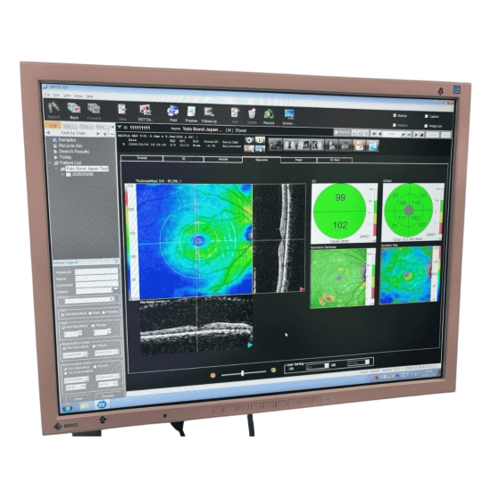 OCT Nidek RS-3000 Advance OCT Nidek RS-3000 Advance