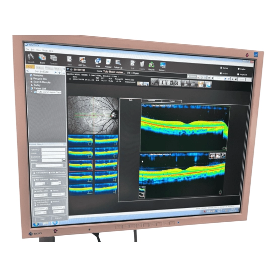 OCT Nidek RS-3000 Advance OCT Nidek RS-3000 Advance