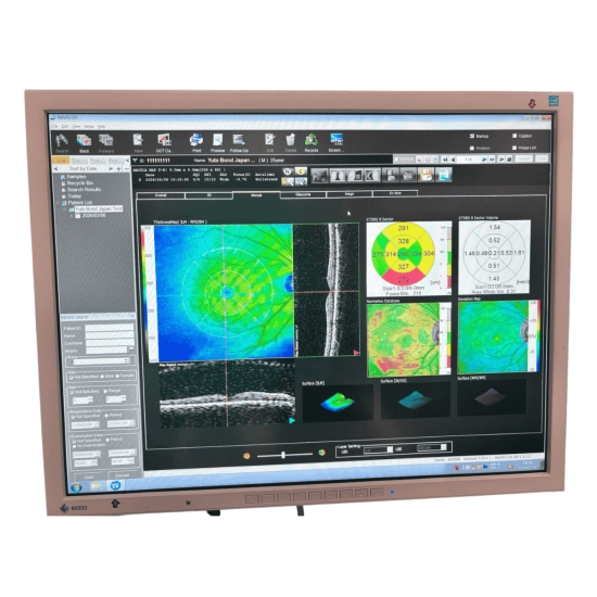 OCT Nidek RS-3000 Advance OCT Nidek RS-3000 Advance