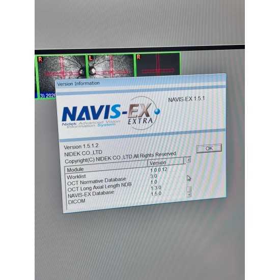 OCT Nidek RS-3000 Advance OCT Nidek RS-3000 Advance